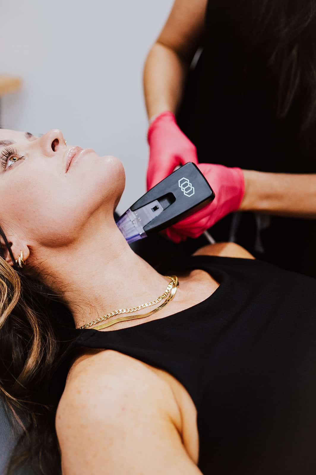 Laser skin treatment